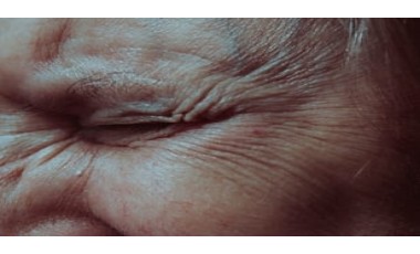 피부 노화를 예방하기 위해 항산화제가 필요한 이유는 무엇일까?